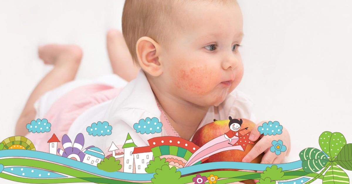 Atopijski dermatitis ili ekcem kod beba i dece